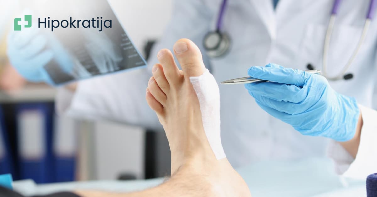 Cover Image for O stopalima - anatomija, nega, najčešća oboljenja