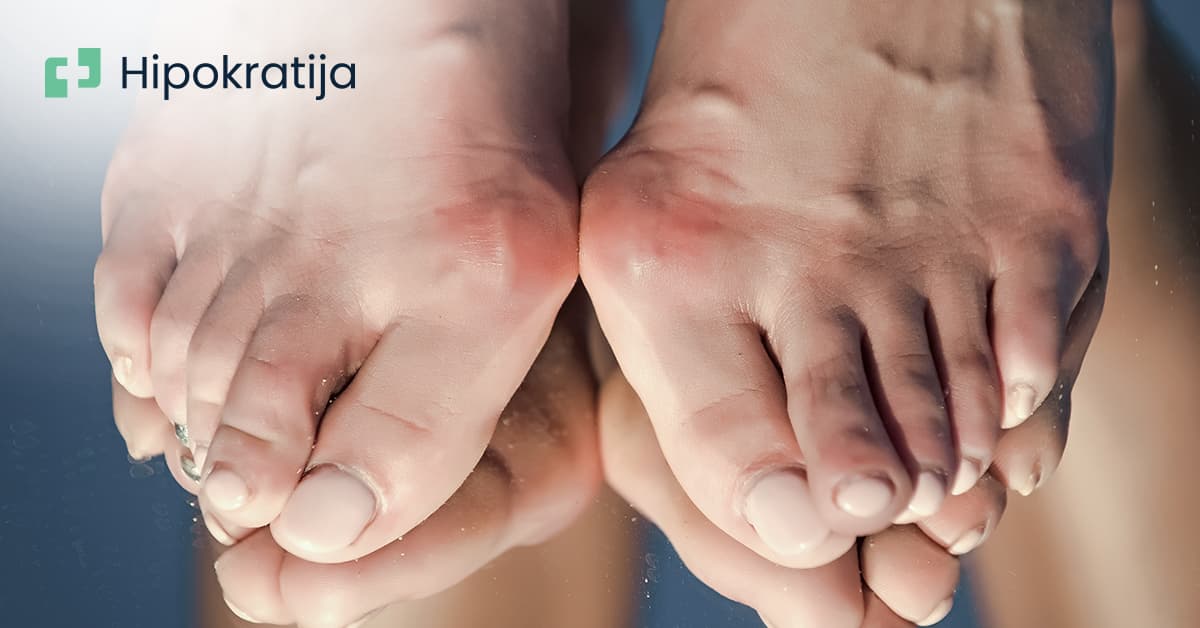 Cover Image for Čukljevi: Uzroci, simptomi i metode liječenja