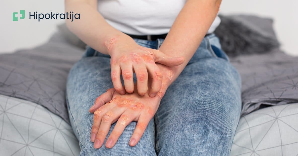 Cover Image for Šuga: Kako prepoznati, liječiti i sprečiti ponavljanje