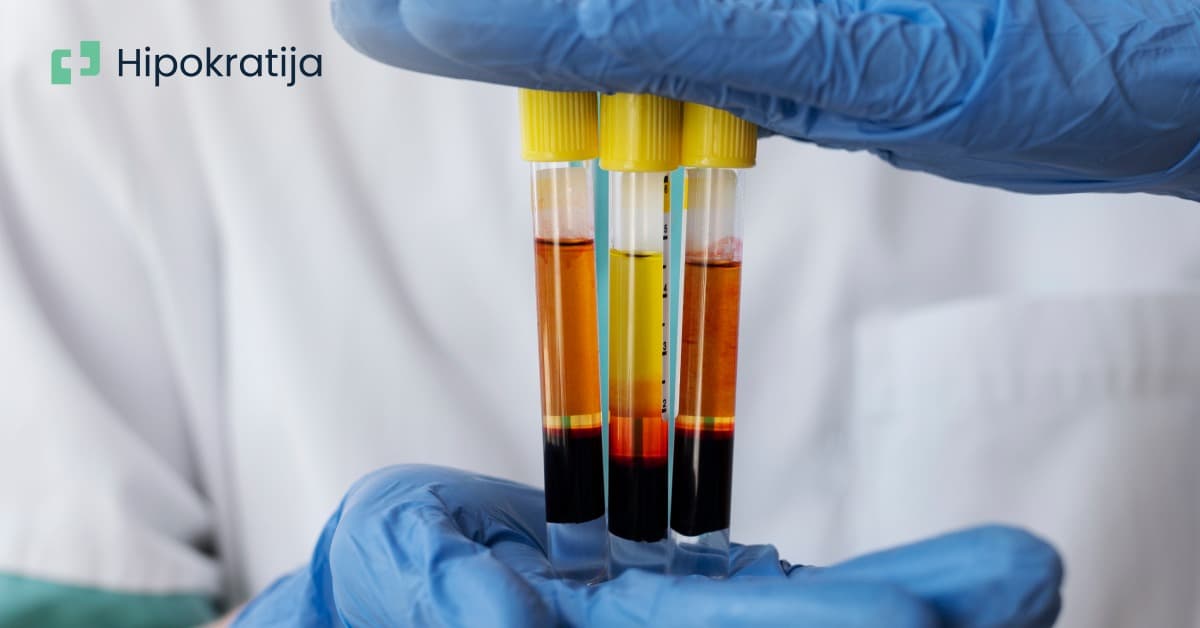 Cover Image for Uloga PRP terapije u regeneraciji kože i kose